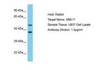 SNX17 Antibody in Western Blot (WB)