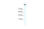 TOP2A Antibody in Western Blot (WB)