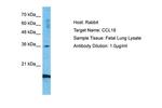 MIP-4 Antibody in Western Blot (WB)