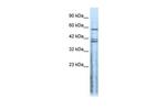 CHRND Antibody in Western Blot (WB)