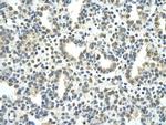 NR2F2 Antibody in Immunohistochemistry (Paraffin) (IHC (P))