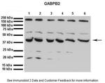 GABPB2 Antibody in Western Blot (WB)