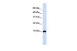 ID1 Antibody in Western Blot (WB)