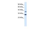 TAL1 Antibody in Western Blot (WB)