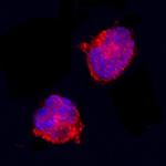 IL1RA Antibody in Immunocytochemistry (ICC/IF)