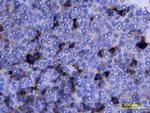 Midkine Antibody in Immunohistochemistry (Paraffin) (IHC (P))