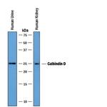 Calbindin D28K Antibody in Western Blot (WB)