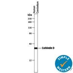 Calbindin D28K Antibody in Western Blot (WB)