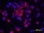 TNF alpha Antibody in Immunocytochemistry (ICC/IF)