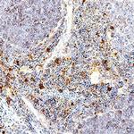 TNF alpha Antibody in Immunohistochemistry (Paraffin) (IHC (P))