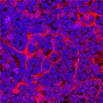 Eotaxin Antibody in Immunohistochemistry (Frozen) (IHC (F))