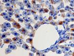 CXCL1 Antibody in Immunohistochemistry (Paraffin) (IHC (P))