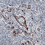 IL-17F Antibody in Immunohistochemistry (Paraffin) (IHC (P))