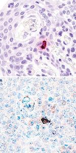 IL-17F Antibody in Immunohistochemistry (Paraffin) (IHC (P))