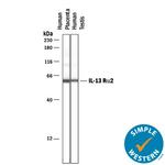 IL13RA2 Antibody in Western Blot (WB)