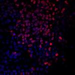 Brachyury Antibody in Immunocytochemistry (ICC/IF)