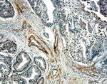 IL15RA Antibody in Immunohistochemistry (Paraffin) (IHC (P))