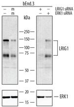 LRIG1 Antibody