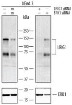 LRIG1 Antibody in Western Blot (WB)