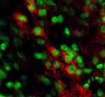 EphB2 Antibody in Immunohistochemistry (Frozen) (IHC (F))