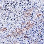 EphB2 Antibody in Immunohistochemistry (Paraffin) (IHC (P))