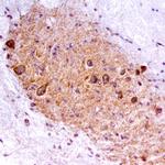 RET Antibody in Immunohistochemistry (Frozen) (IHC (F))