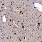 Neuropilin 1 Antibody in Immunohistochemistry (Paraffin) (IHC (P))