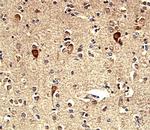 TROP2 Antibody in Immunohistochemistry (Paraffin) (IHC (P))