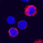 ADAM8 Antibody in Immunocytochemistry (ICC/IF)