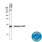 Cathepsin C Antibody in Western Blot (WB)