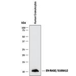 S100A12 Antibody in Western Blot (WB)
