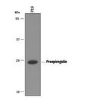 Epiregulin Antibody in Western Blot (WB)