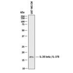 IL36B Antibody in Western Blot (WB)