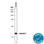 Galectin 7 Antibody in Western Blot (WB)