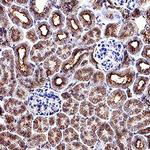 PDGF-C Antibody in Immunohistochemistry (Paraffin) (IHC (P))