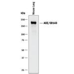 ACE Antibody in Western Blot (WB)