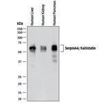 SERPINA4 Antibody in Western Blot (WB)