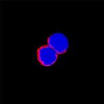 ITGA2 Antibody in Immunocytochemistry (ICC/IF)