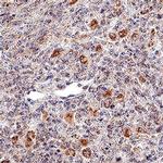 NKp46 Antibody in Immunohistochemistry (Paraffin) (IHC (P))