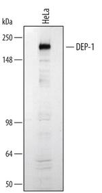 CD148 Antibody in Western Blot (WB)