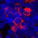 TNFAIP6 Antibody in Immunocytochemistry (ICC/IF)