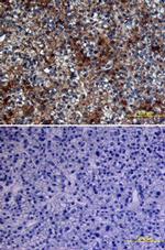 Glypican 3 Antibody in Immunohistochemistry (Paraffin) (IHC (P))