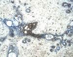 Glypican 3 Antibody in Immunohistochemistry (Paraffin) (IHC (P))