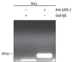 GATA5 Antibody in ChIP Assay (ChIP)