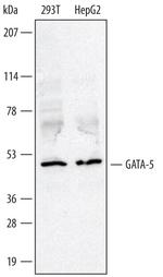 GATA5 Antibody in Western Blot (WB)