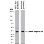 Carbonic Anhydrase VIII Antibody in Western Blot (WB)