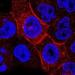 Carbonic Anhydrase IX Antibody in Immunocytochemistry (ICC/IF)