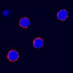 SCF Antibody in Immunocytochemistry (ICC/IF)