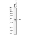 CHIL3 Antibody in Western Blot (WB)