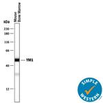 CHIL3 Antibody in Western Blot (WB)